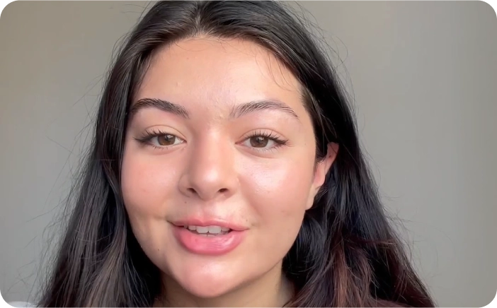 Sophia talks about her acne journey to better skin with Included Health