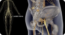 image of sciatica x ray